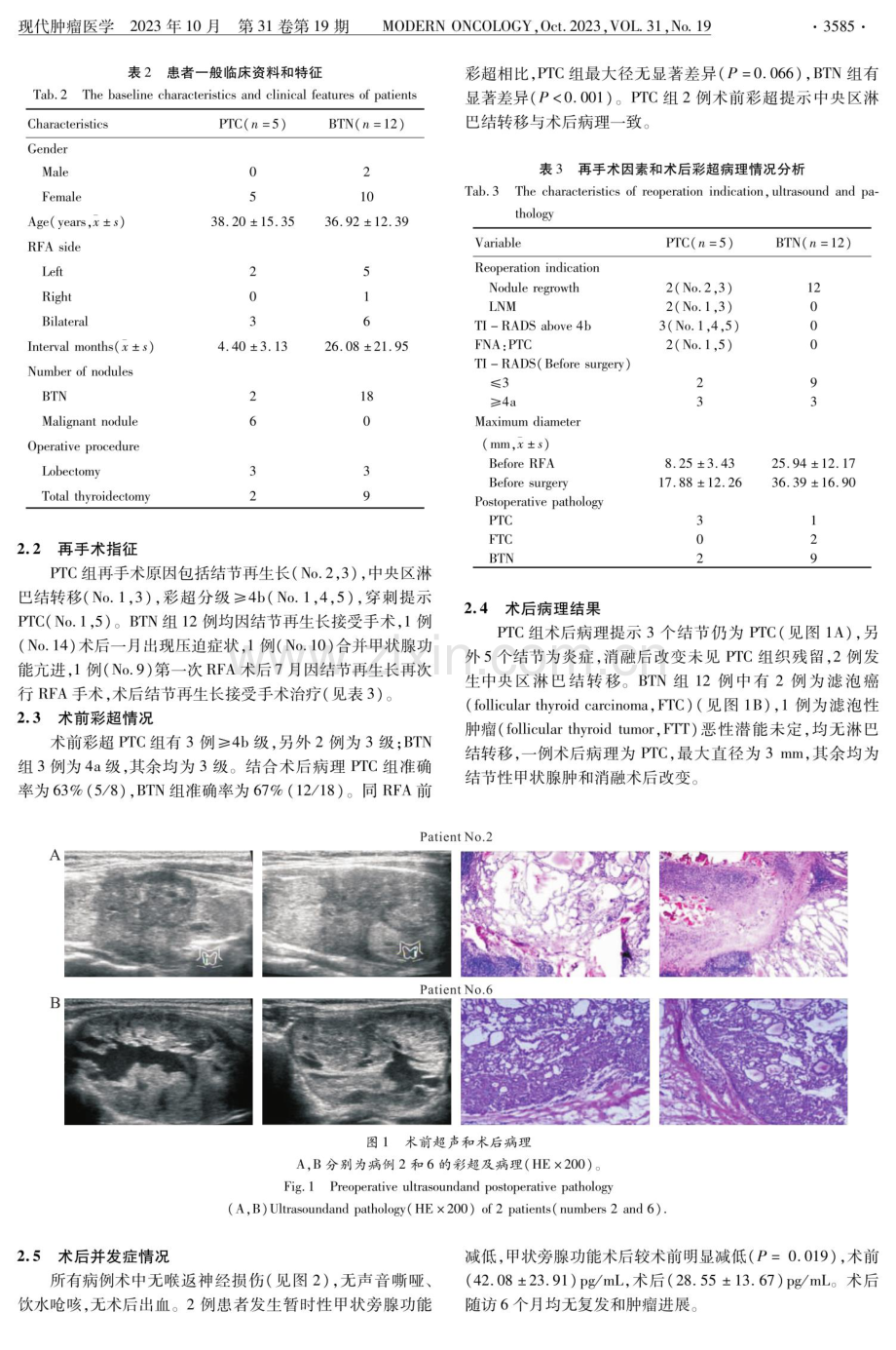 甲状腺肿瘤射频消融治疗后再手术临床分析.pdf_第3页