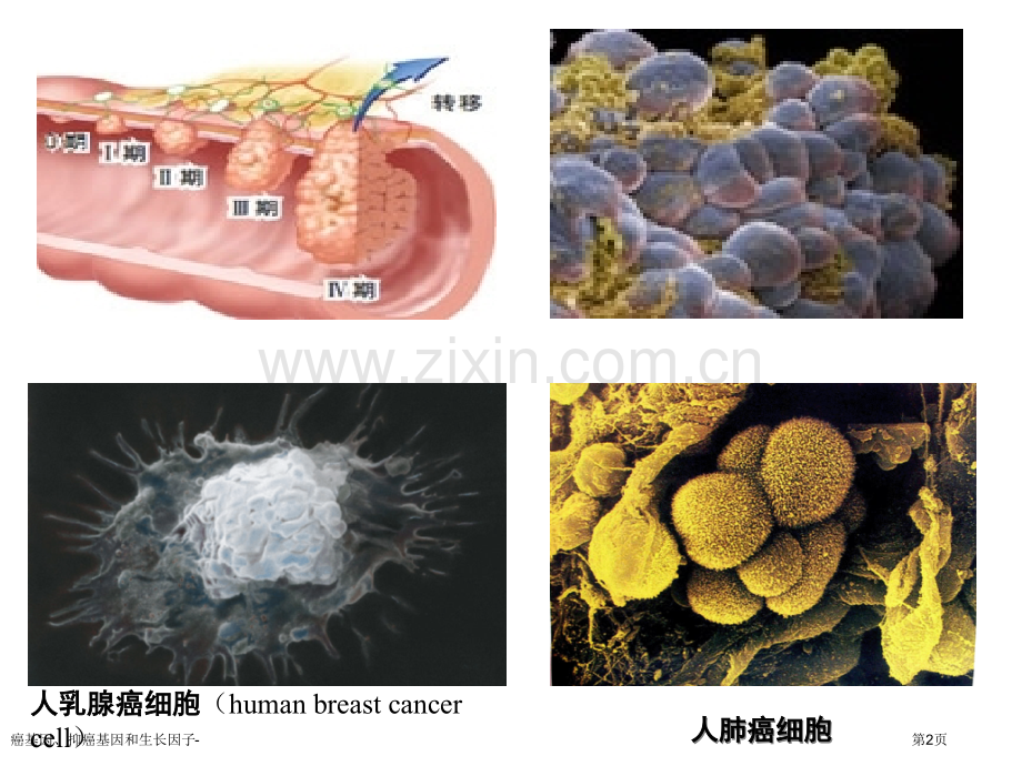 癌基因、抑癌基因和生长因子-专家讲座.pptx_第2页