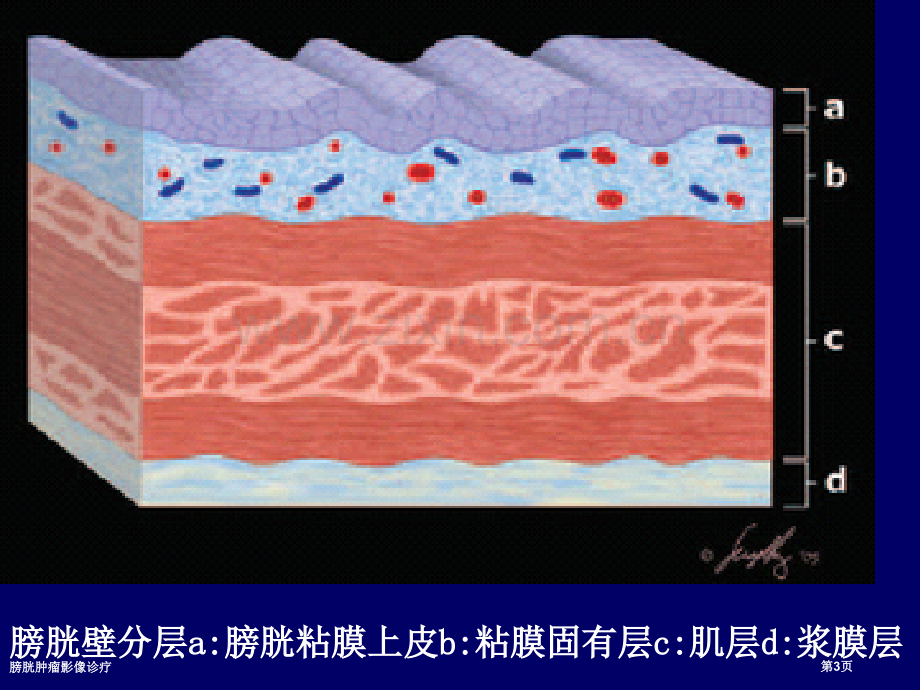 膀胱肿瘤影像诊疗.pptx_第3页