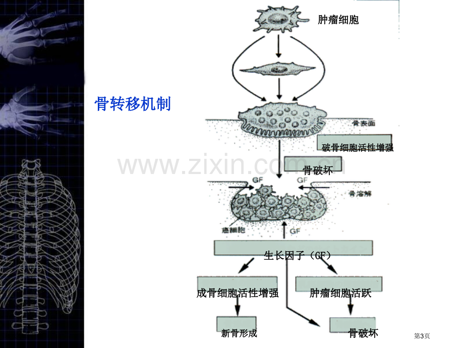 核医学骨显像专家讲座.pptx_第3页