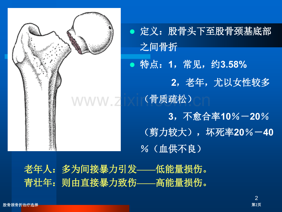 股骨颈骨折治疗选择.pptx_第2页