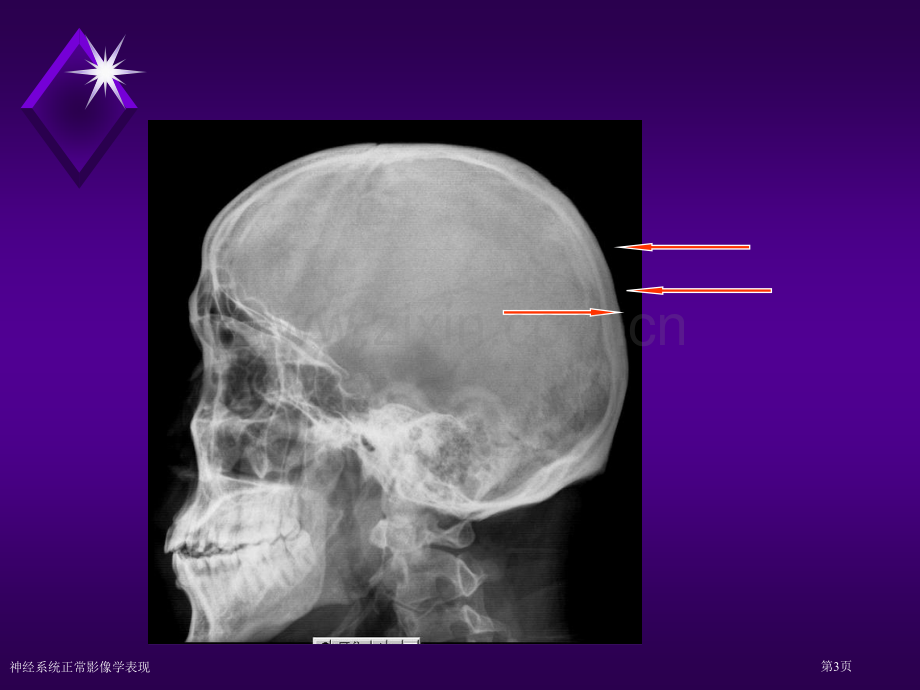 神经系统正常影像学表现.pptx_第3页