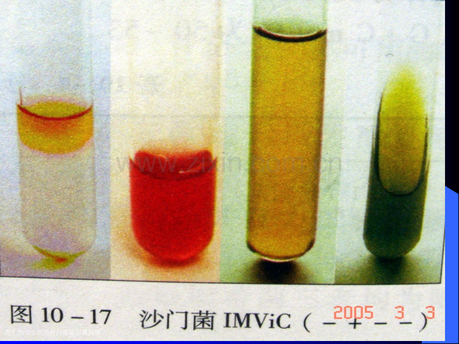 微生物学志贺菌沙门菌耶尔森菌属专家讲座.pptx_第3页