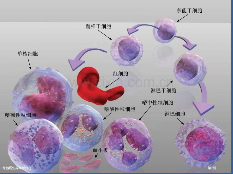 骨髓增生异常综合征.pptx_第2页