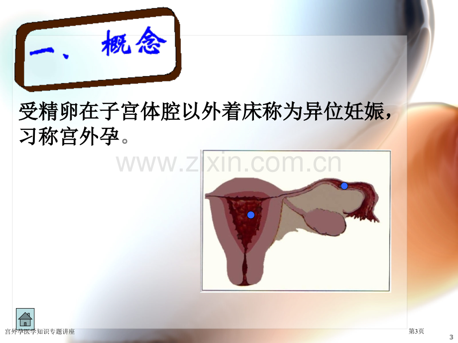 宫外孕医学知识专题讲座.pptx_第3页