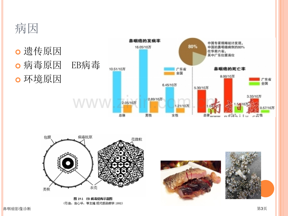 鼻咽癌影像诊断.pptx_第3页