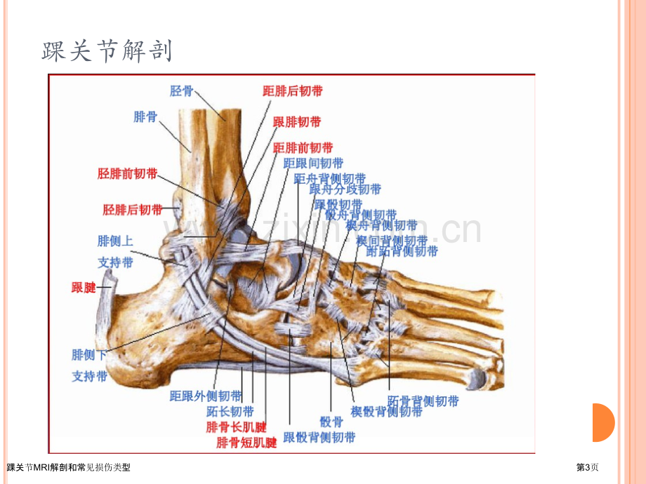 踝关节MRI解剖和常见损伤类型.pptx_第3页