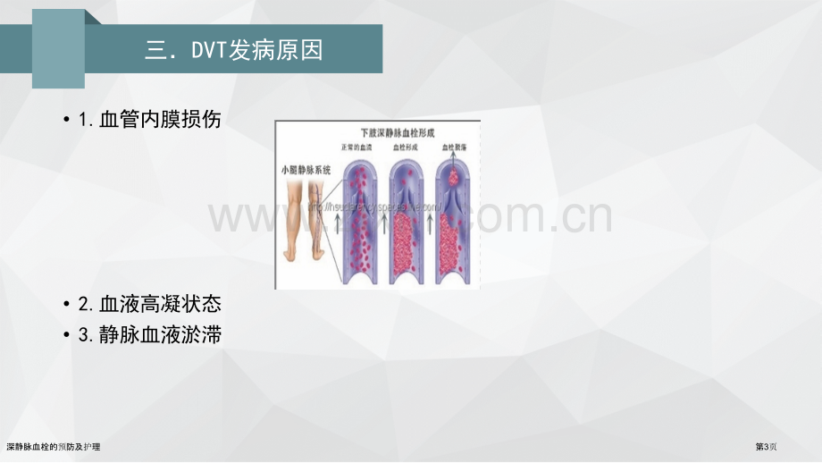 深静脉血栓的预防及护理.pptx_第3页