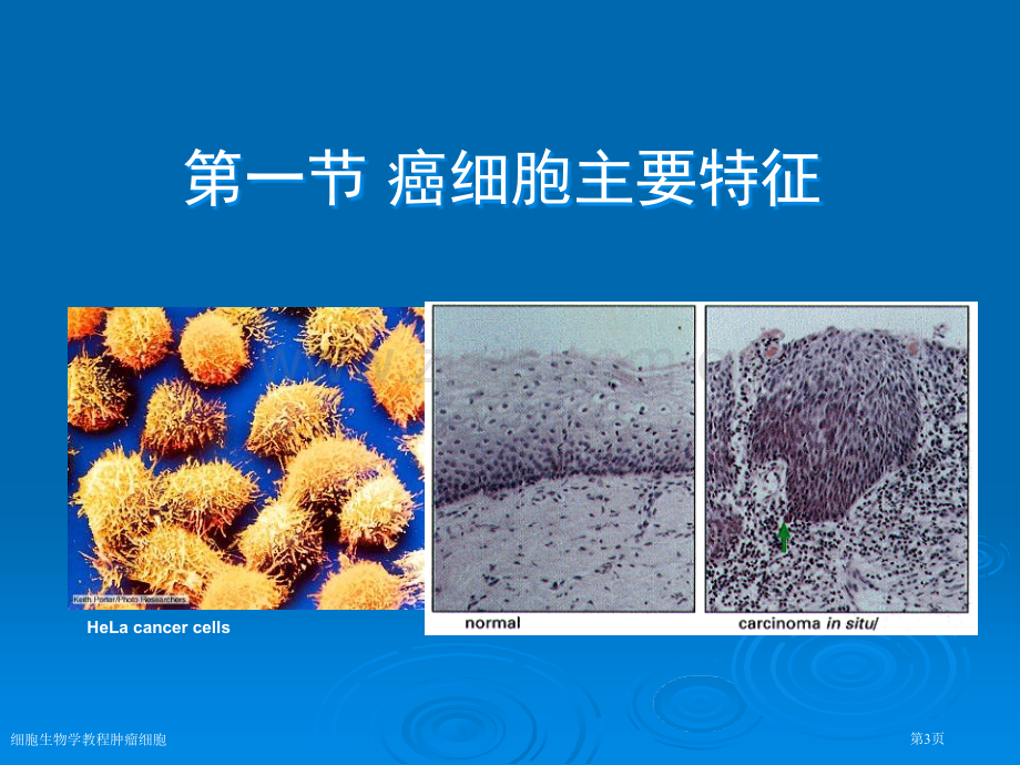 细胞生物学教程肿瘤细胞专家讲座.pptx_第3页