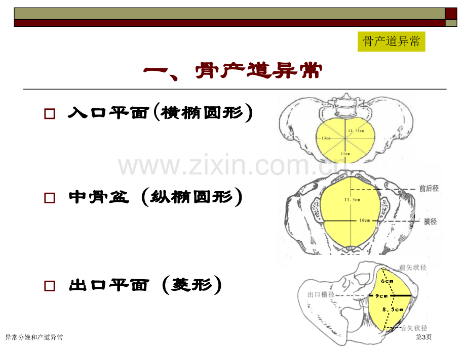 异常分娩和产道异常专家讲座.pptx_第3页