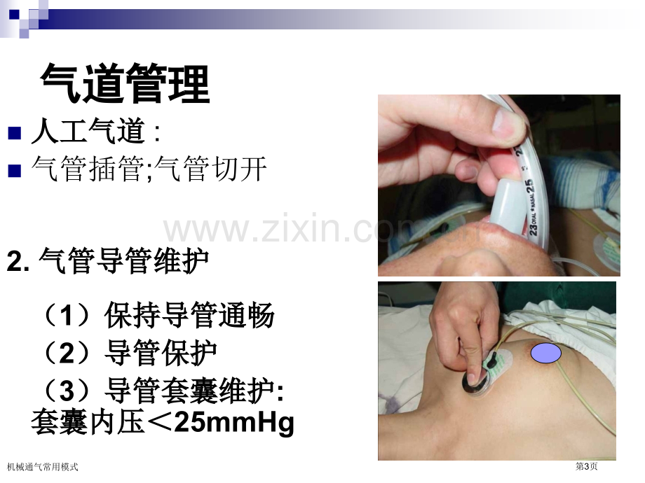 机械通气常用模式.pptx_第3页