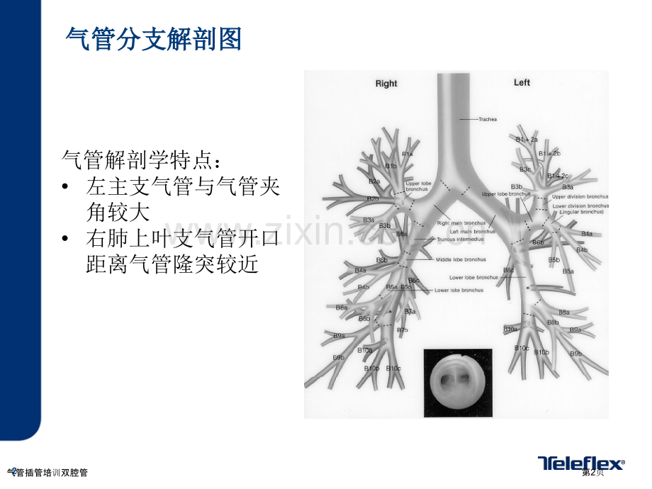 气管插管培训双腔管.pptx_第2页