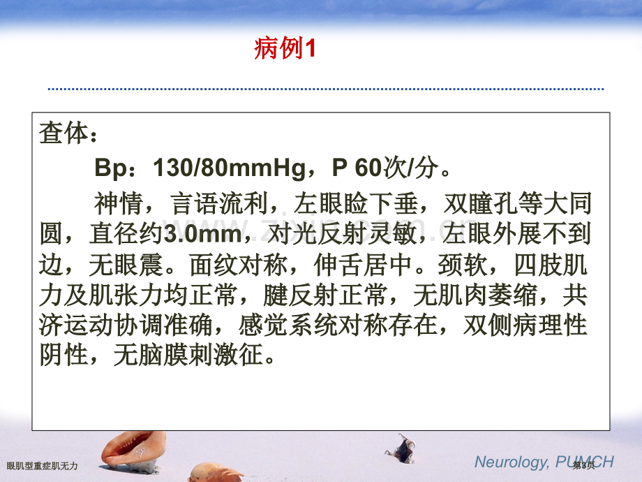 眼肌型重症肌无力.pptx_第3页