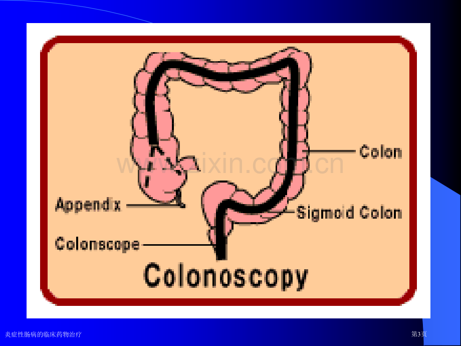 炎症性肠病的临床药物治疗专家讲座.pptx_第3页
