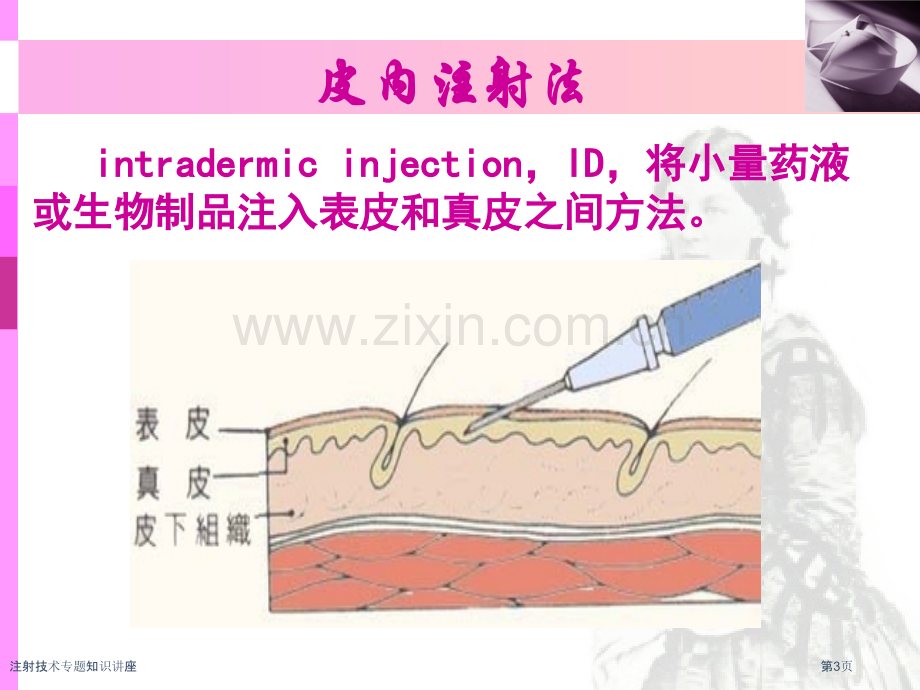 注射技术专题知识讲座专家讲座.pptx_第3页