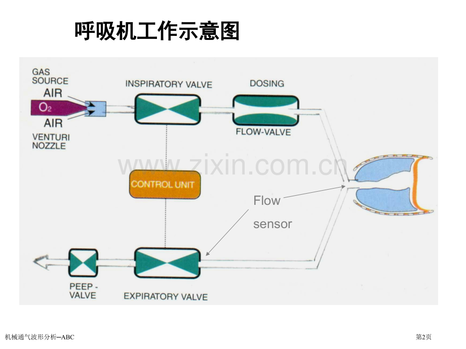 机械通气波形分析─ABC专家讲座.pptx_第2页