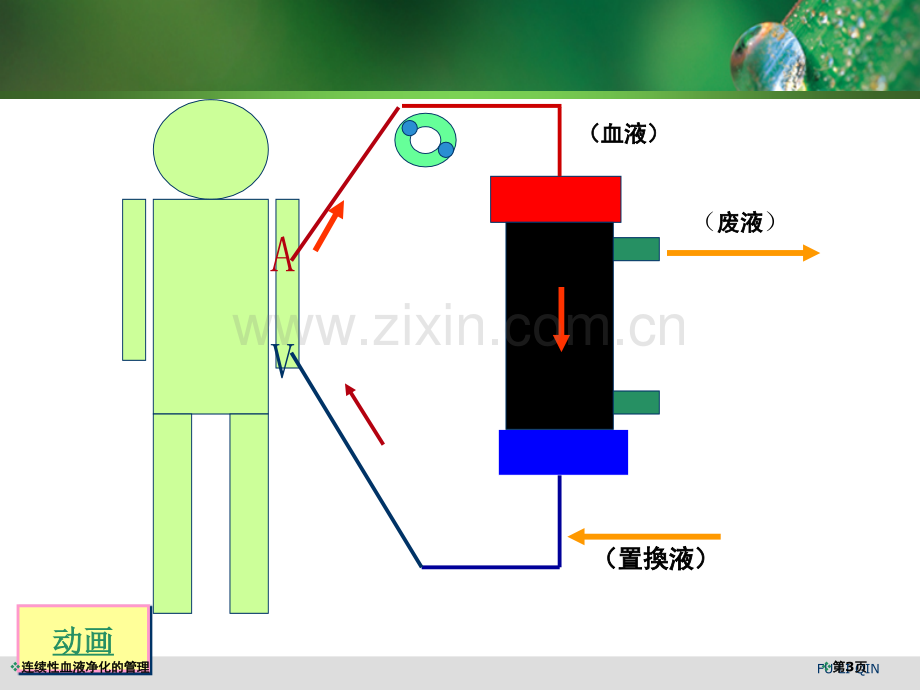 连续性血液净化的管理专家讲座.pptx_第3页