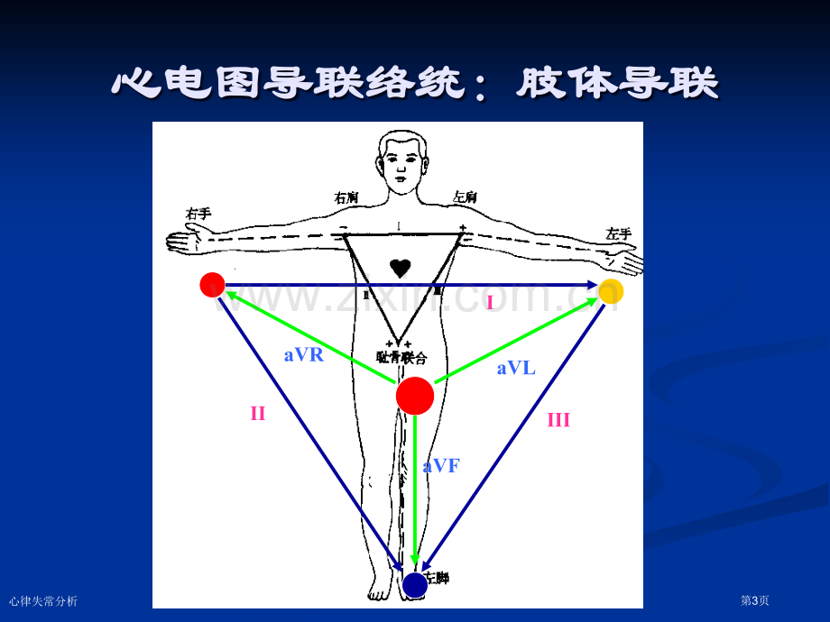 心律失常分析专家讲座.pptx_第3页