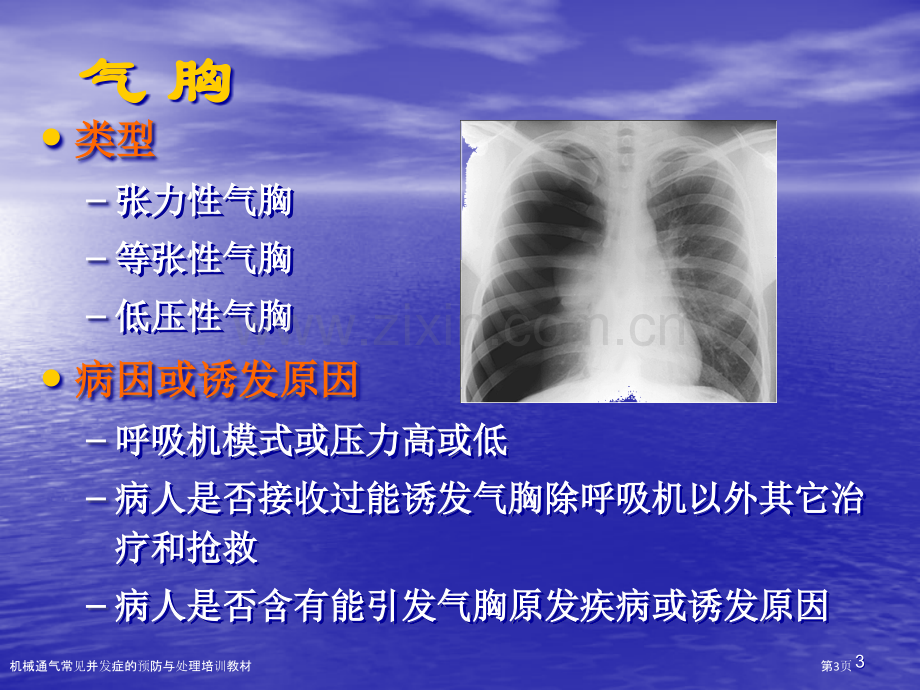 机械通气常见并发症的预防与处理培训教材.pptx_第3页