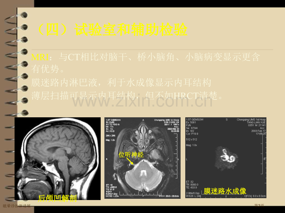 眩晕诊治新进展专家讲座.pptx_第2页