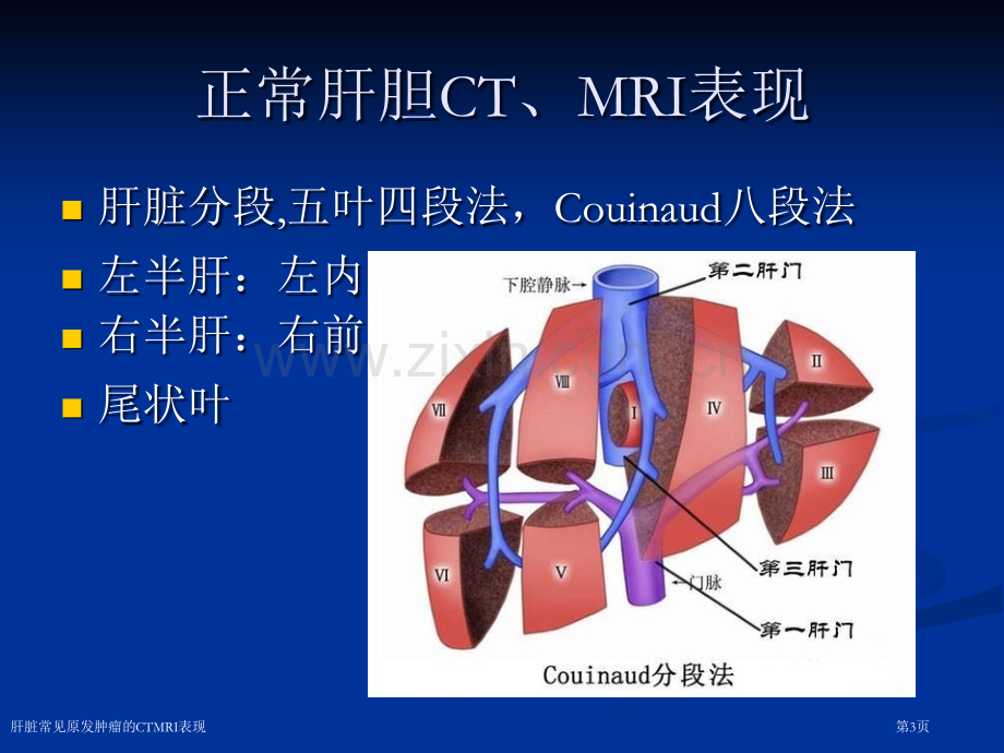 肝脏常见原发肿瘤的CTMRI表现.pptx_第3页