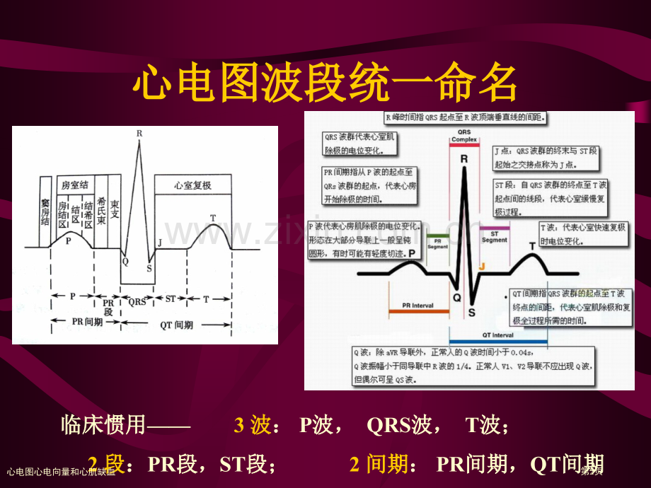 心电图心电向量和心肌缺血专家讲座.pptx_第1页