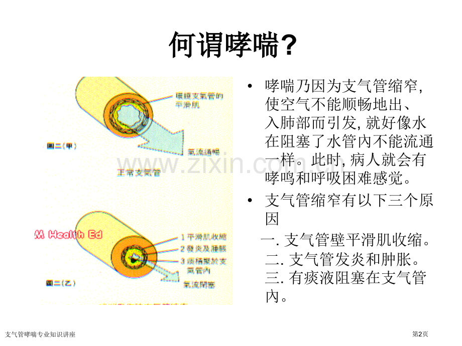 支气管哮喘专业知识讲座专家讲座.pptx_第2页