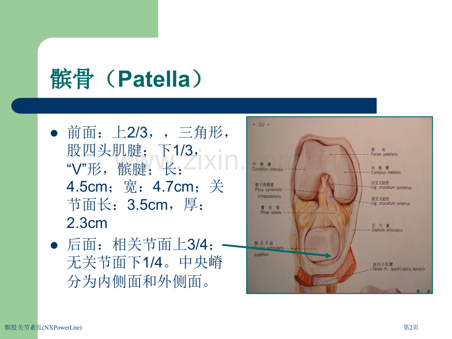 髌股关节紊乱(NXPowerLite)专家讲座.pptx_第2页