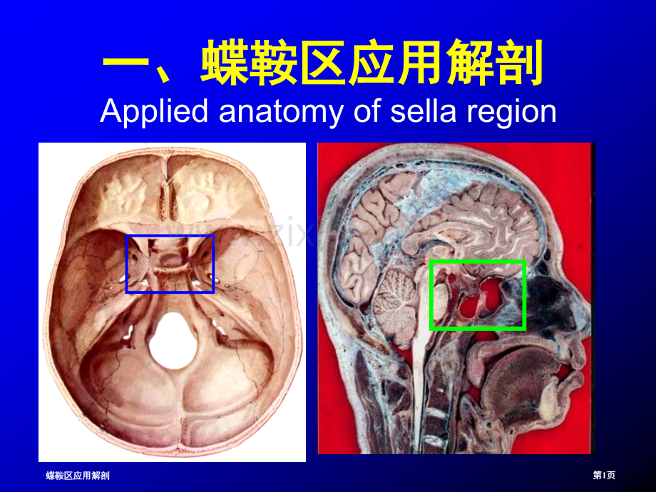 蝶鞍区应用解剖.pptx_第1页