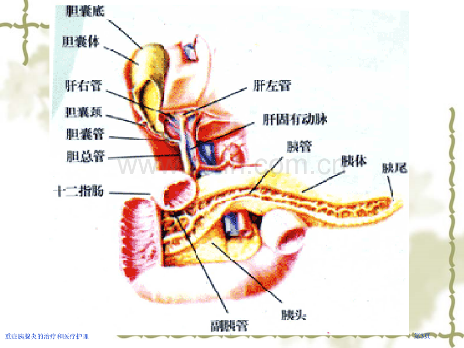 重症胰腺炎的治疗和医疗护理.pptx_第3页