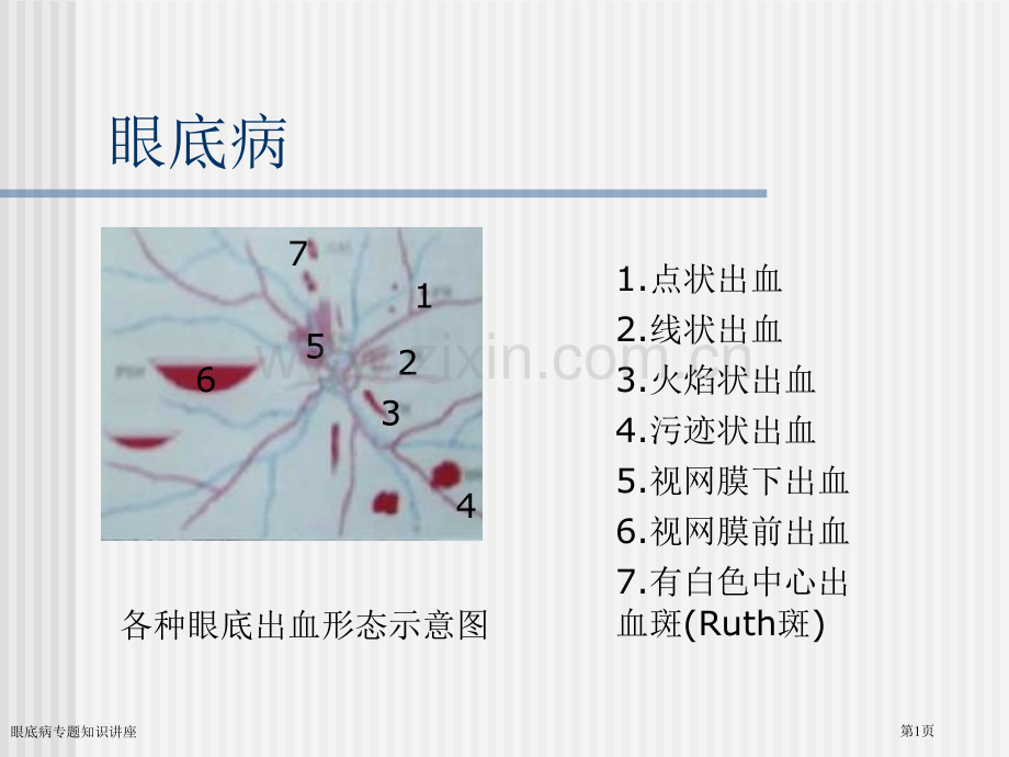 眼底病专题知识讲座专家讲座.pptx_第1页