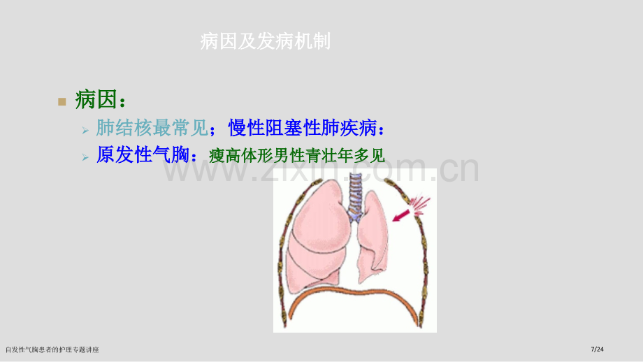 自发性气胸患者的护理专题讲座.pptx_第3页