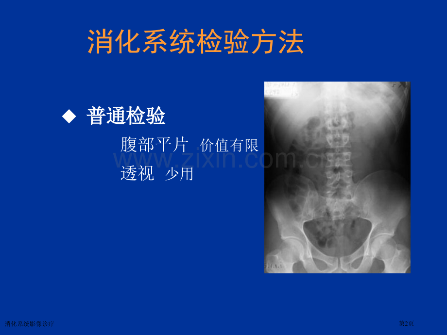 消化系统影像诊疗专家讲座.pptx_第2页