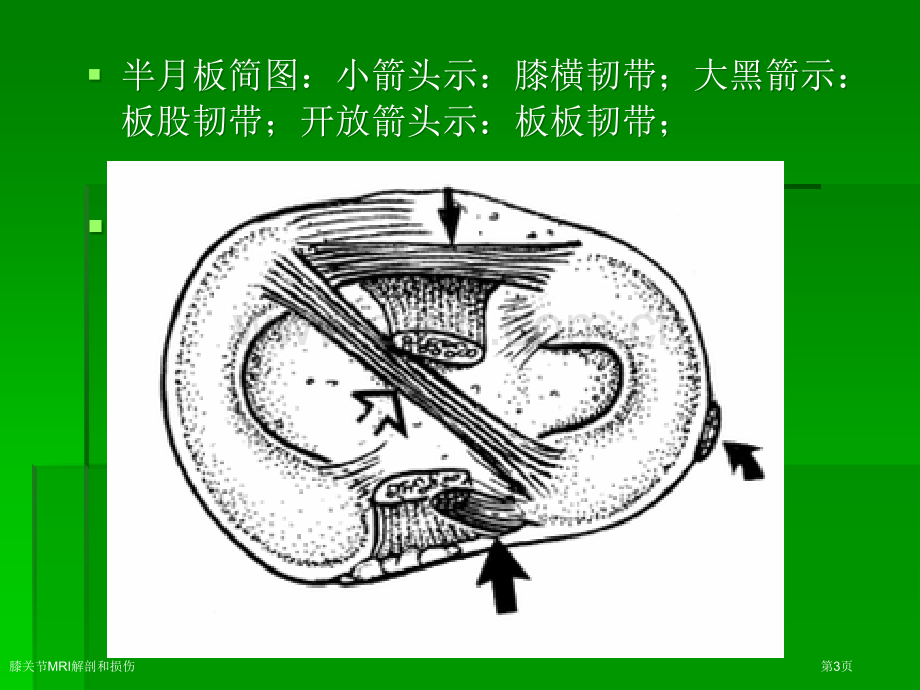 膝关节MRI解剖和损伤专家讲座.pptx_第3页