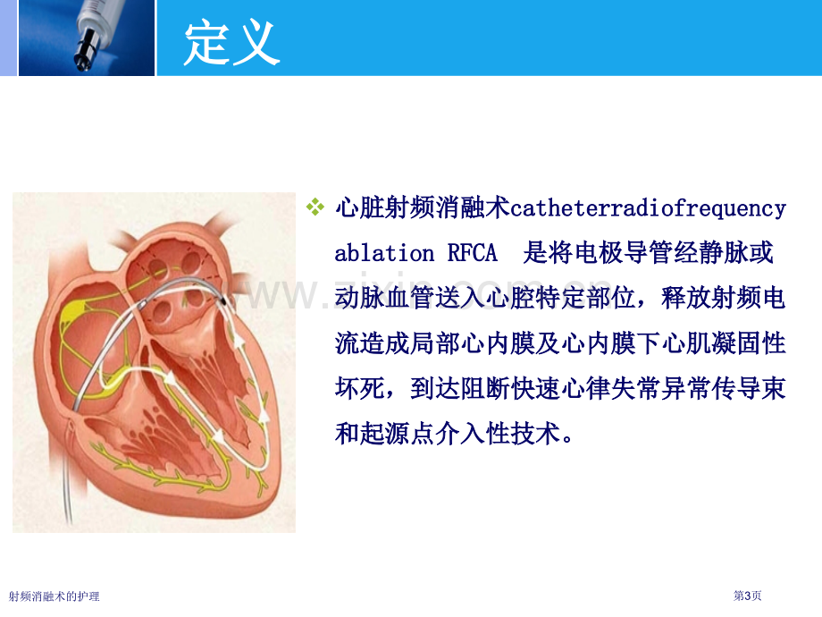 射频消融术的护理专家讲座.pptx_第3页