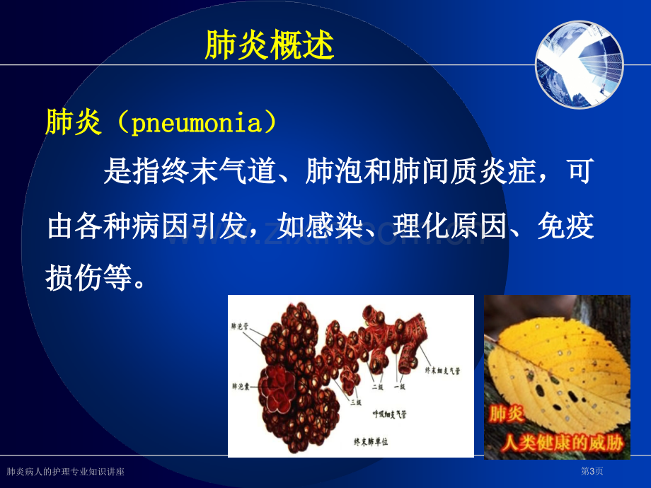 肺炎病人的护理专业知识讲座.pptx_第3页