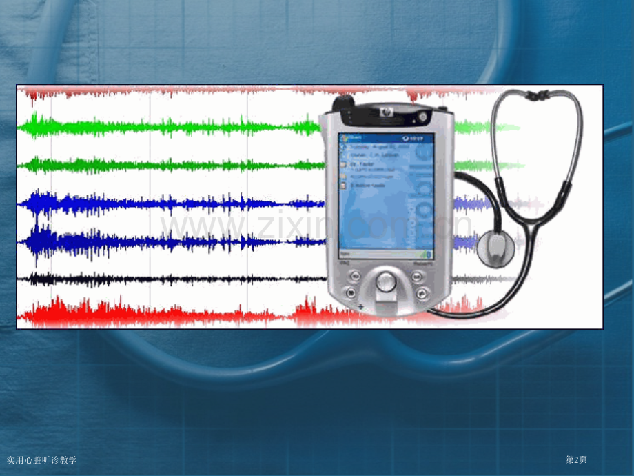 实用心脏听诊教学专家讲座.pptx_第2页