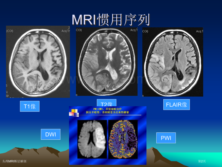 头颅MRI断层解剖专家讲座.pptx_第2页