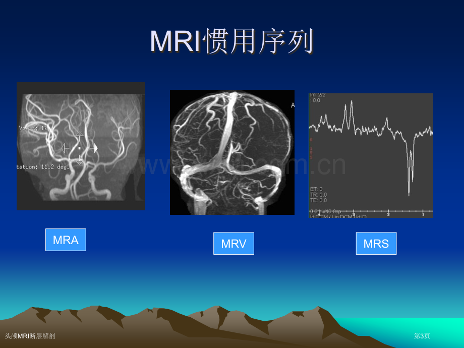 头颅MRI断层解剖专家讲座.pptx_第3页