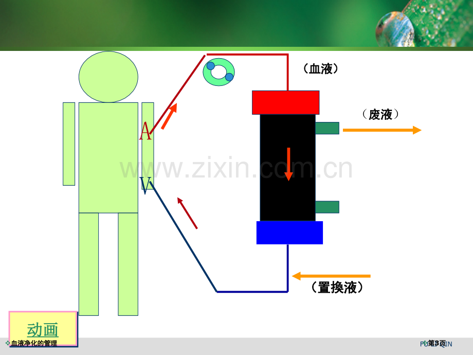 血液净化的管理专家讲座.pptx_第3页