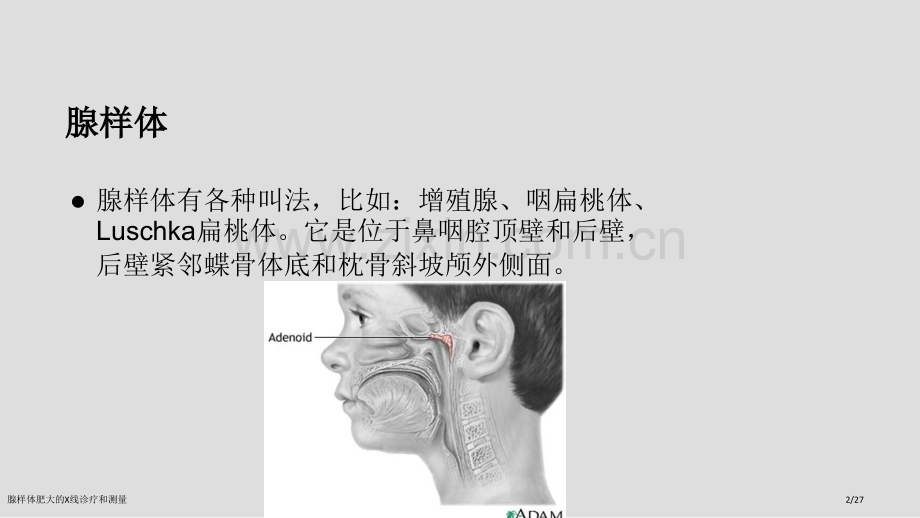 腺样体肥大的X线诊疗和测量.pptx_第2页