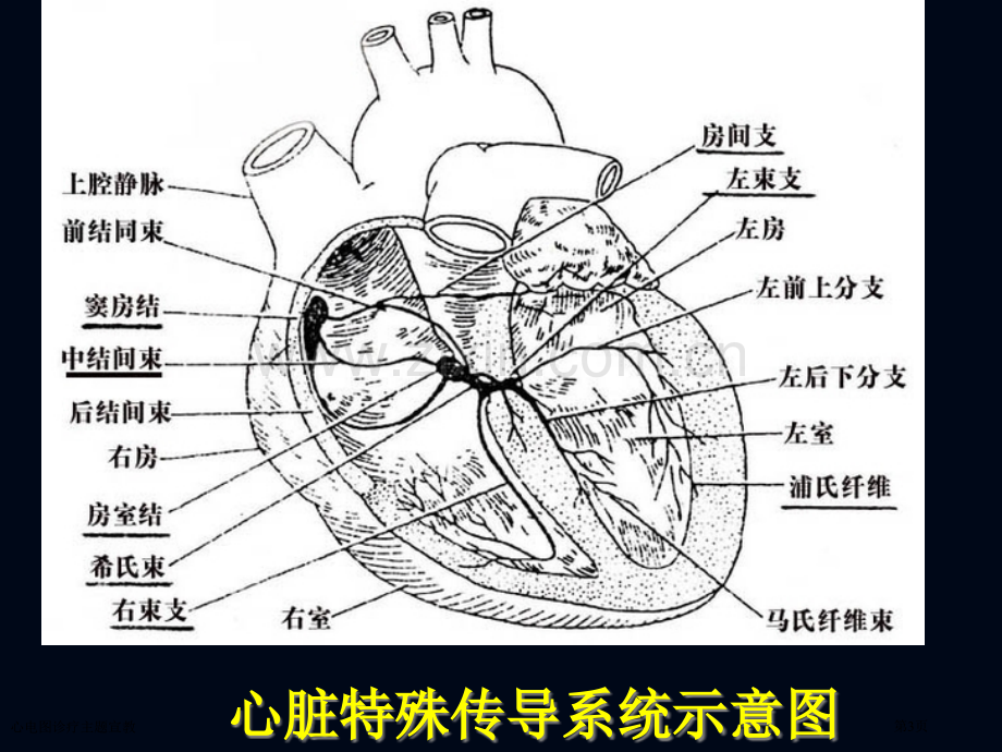 心电图诊疗主题宣教专家讲座.pptx_第3页