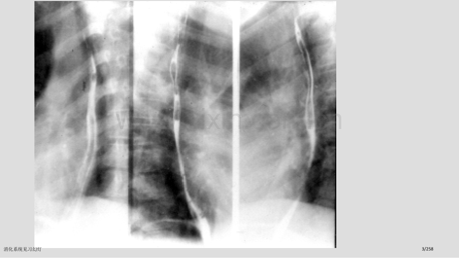 消化系统见习幻灯.pptx_第3页