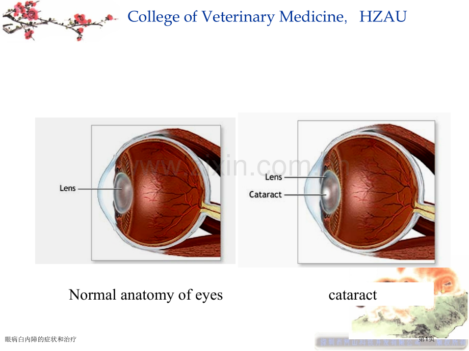 眼病白内障的症状和治疗专家讲座.pptx_第1页