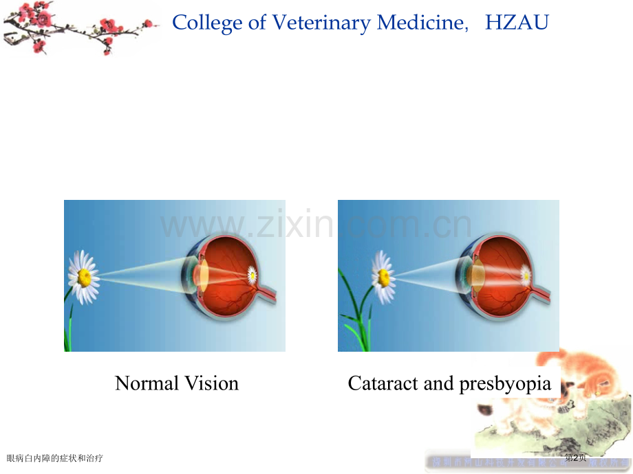 眼病白内障的症状和治疗专家讲座.pptx_第2页