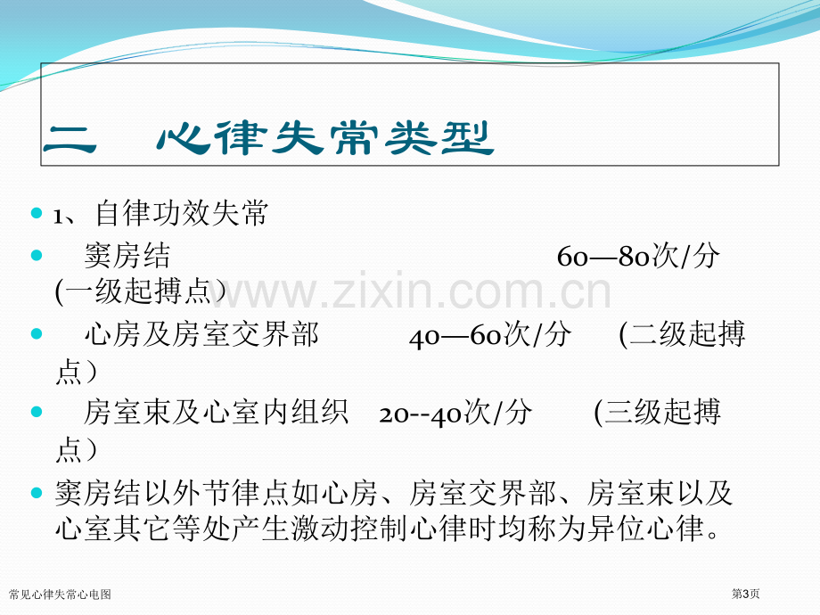 常见心律失常心电图.pptx_第3页