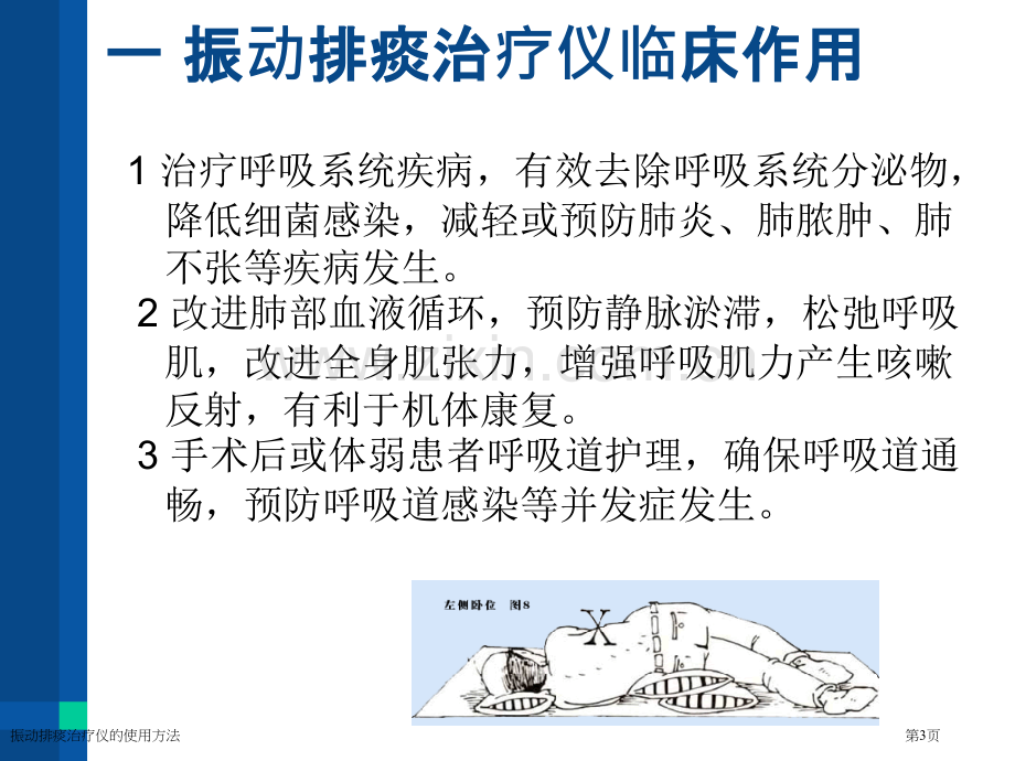 振动排痰治疗仪的使用方法专家讲座.pptx_第3页