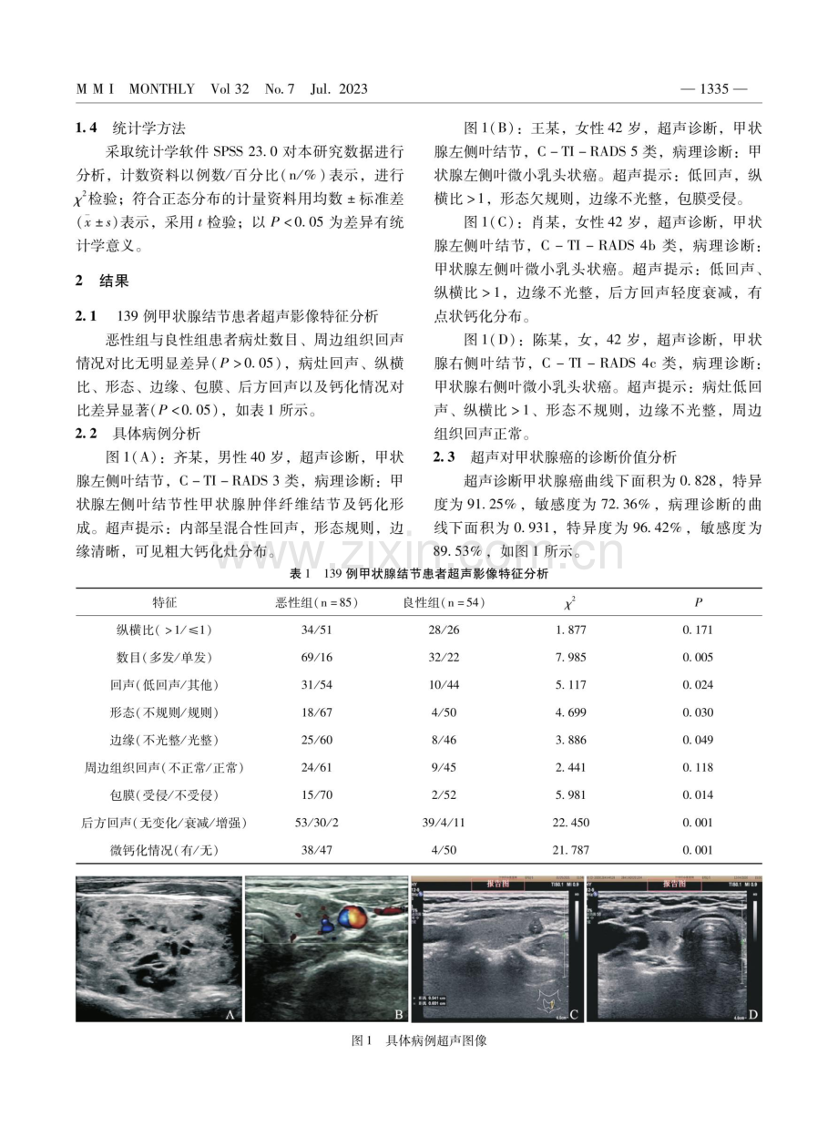 甲状腺超声影像特征在甲状腺癌中的诊断价值.pdf_第2页