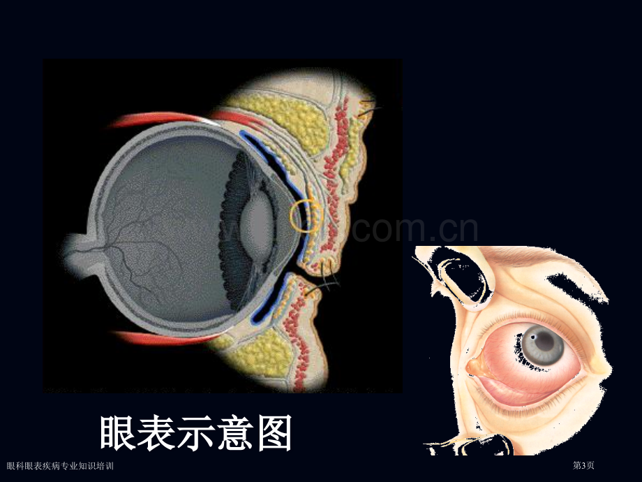 眼科眼表疾病专业知识培训专家讲座.pptx_第3页