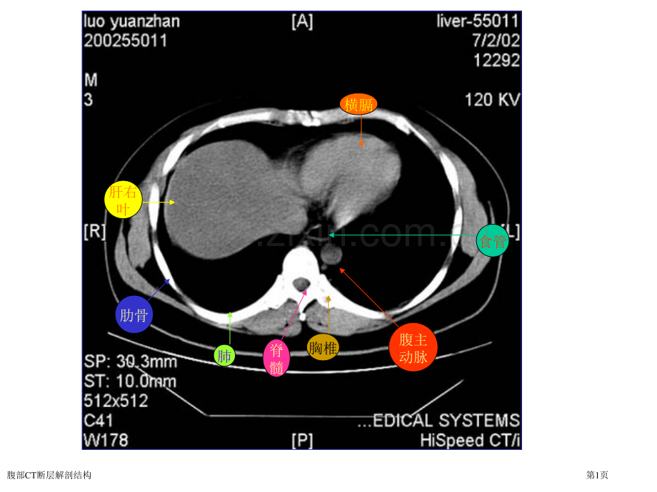 腹部CT断层解剖结构.pptx_第1页
